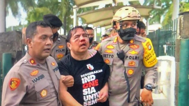 Foto: Ade Armando Babak Belur Dipukuli Massa Aksi di Gedung DPR | Pifa Net