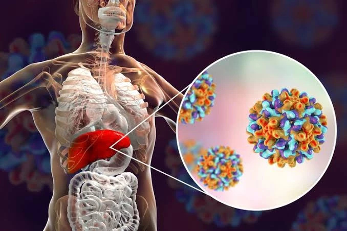 Foto: Waspadai, Ini Gejala Hepatitis Akut Misterius Menurut Ikatan Dokter Anak Indonesia | Pifa Net