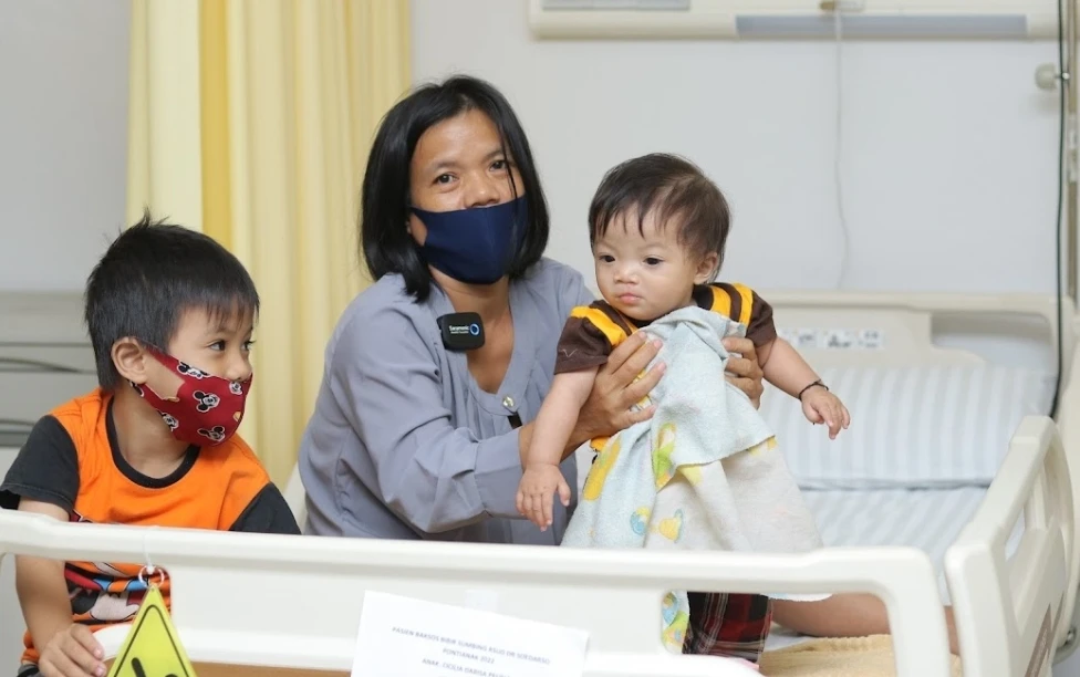 Salah satu pasien operasi bibir sumbing. (Foto: Dok. PIFA)