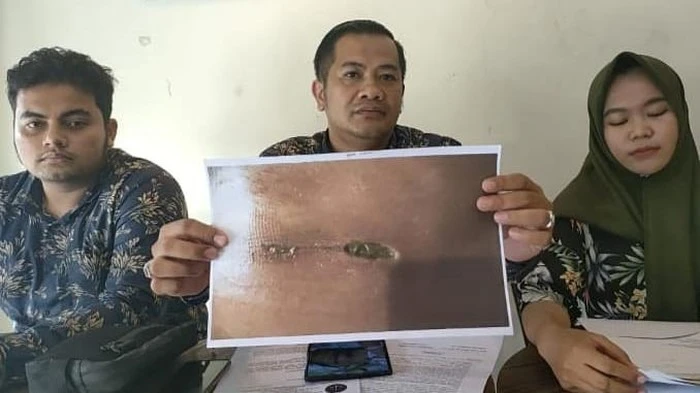Foto: Kelamin Remaja Dilaporkan Membusuk usai Operasi Usus Buntu, Pihak RS: Miskomunikasi Saja | Pifa Net