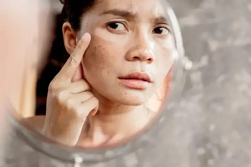 Penyebab penuaan dini akibat salah menggunakan produk skincare, salah satunya karena terlalu banyak gunakan produk. (Ilustrasi: webmd.com)