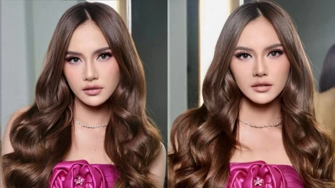 Foto: Selain Mahalini, 5 Artis Ini Juga Operasi Hidung  | Pifa Net