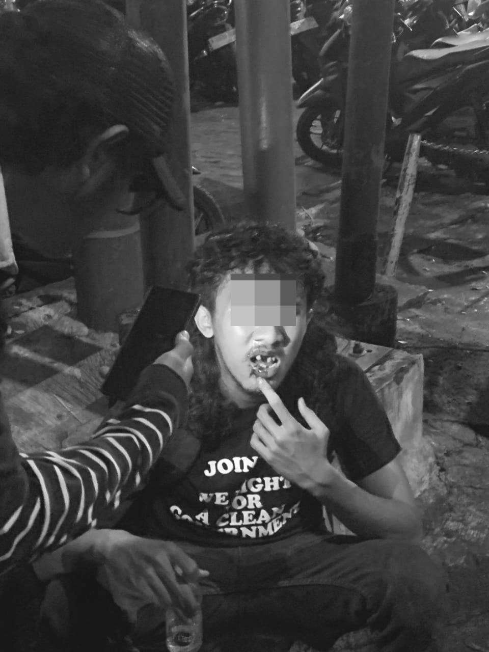 Foto: Aksi Tolak UU TNI di Malang: Tim Medis hingga Jurnalis Jadi Korban Kekerasan Aparat | Pifa Net