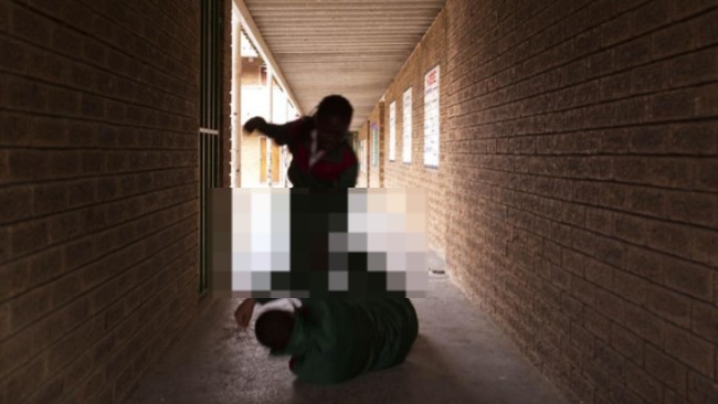 Foto: Visum Kasus BINUS SCHOOL Simprug: Tidak Ada Rahang Bengkok, Bertolak Belakang dengan Klaim Pelapor | Pifa Net