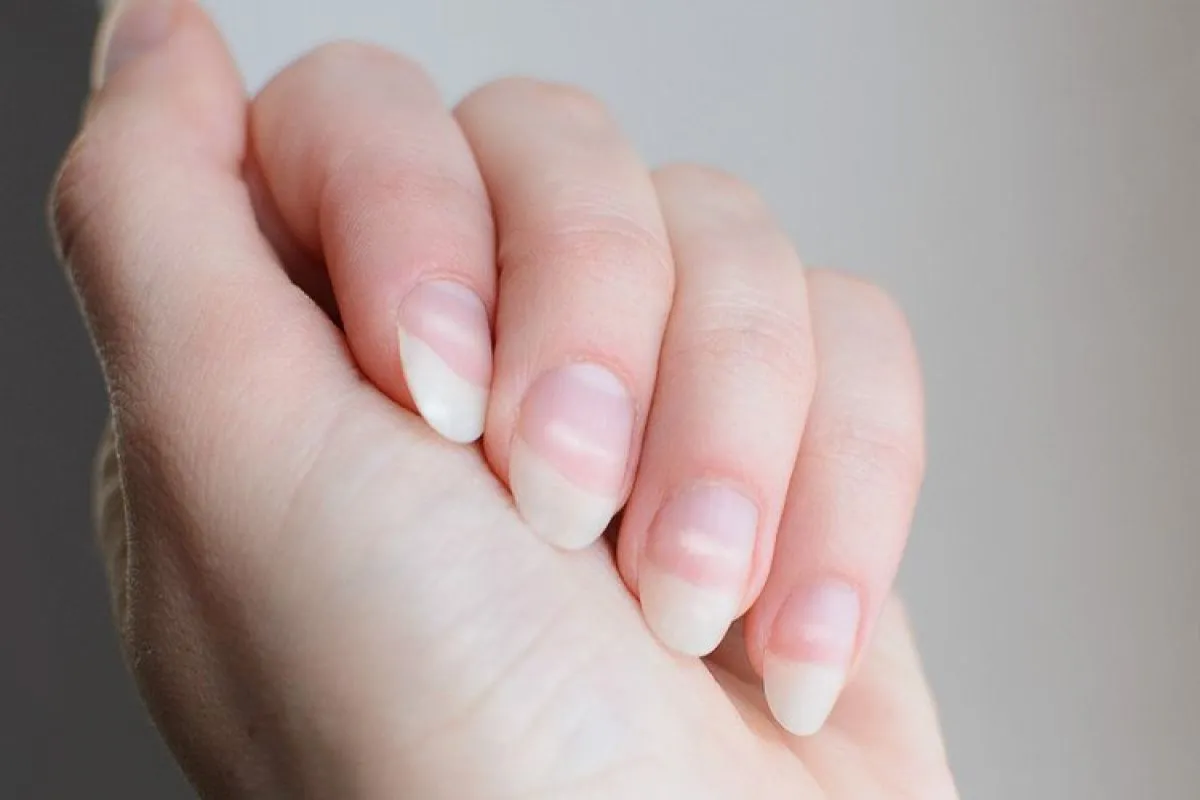 Foto: Perubahan pada Tangan dan Kuku Bisa Jadi Sinyal Masalah Kesehatan Serius | Pifa Net