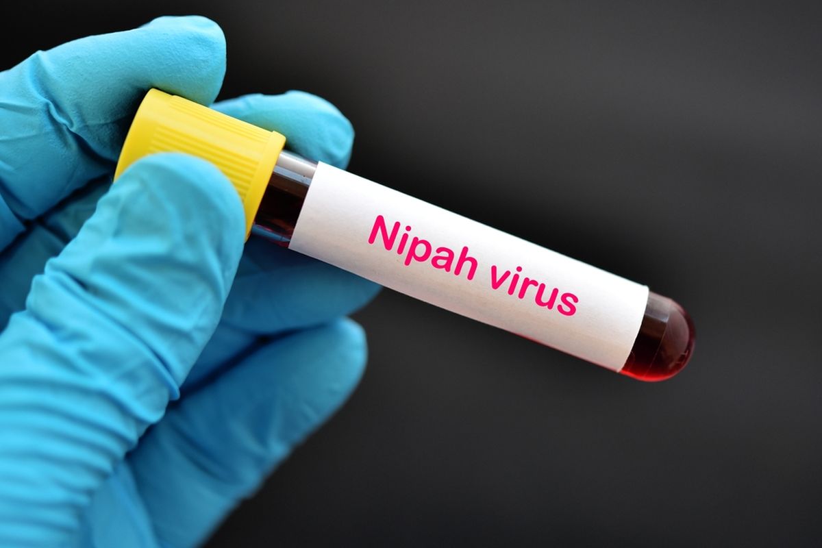 Foto: Pakar Kesehatan Dorong Indonesia Contoh Negara Tetangga Cegah Penularan Virus Nipah | Pifa Net