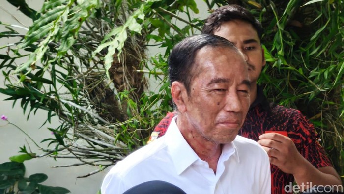 Foto: Heboh Perubahan Kulit Wajah Jokowi, Ajudan Jelaskan Penyebabnya | Pifa Net